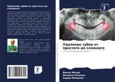 Bookcover of Удаление зубов от простого до сложного