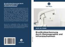 Buchcover von Brustkrebserkennung durch Mammographie und Infrarotaufnahmen