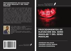 Buchcover von PROCEDIMIENTOS DE ELEVACIÓN DEL SENO MAXILAR Y DEL SENO MAXILAR