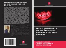 Buchcover von PROCEDIMENTOS DE ELEVAÇÃO DO SEIO MAXILAR E DO SEIO MAXILAR