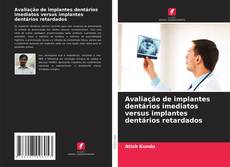 Обложка Avaliação de implantes dentários imediatos versus implantes dentários retardados