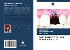 Buchcover von FORTSCHRITTE BEI DER PERIIMPLANTITIS