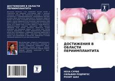 Buchcover von ДОСТИЖЕНИЯ В ОБЛАСТИ ПЕРИИМПЛАНТИТА