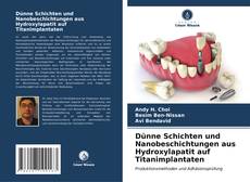 Bookcover of Dünne Schichten und Nanobeschichtungen aus Hydroxylapatit auf Titanimplantaten