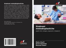 Bookcover of Sindromi mielodisplastiche