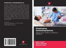Buchcover von Síndromes mielodisplásicas