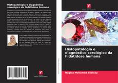Couverture de Histopatologia e diagnóstico serológico da hidatidose humana