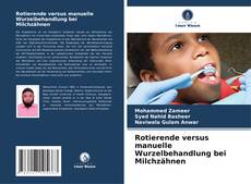 Bookcover of Rotierende versus manuelle Wurzelbehandlung bei Milchzähnen