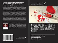 Capa do livro de Evaluación de los niveles de MDA, HbA1c y SOD en la Retinopatía Diabética tipo 2 