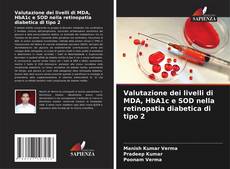 Bookcover of Valutazione dei livelli di MDA, HbA1c e SOD nella retinopatia diabetica di tipo 2