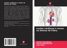 Buchcover von Lesões cardíacas e renais na doença de Fabry