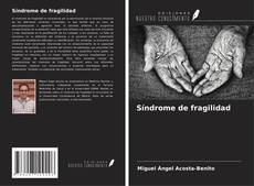 Bookcover of Síndrome de fragilidad
