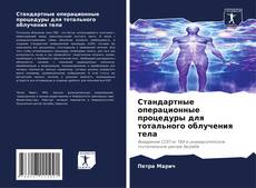 Bookcover of Стандартные операционные процедуры для тотального облучения тела