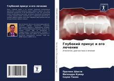 Bookcover of Глубокий прикус и его лечение