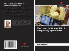 Buchcover von The contribution of MRI in ankylosing spondylitis