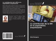 Couverture de La contribución de la RM en la espondilitis anquilosante