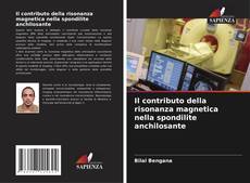 Buchcover von Il contributo della risonanza magnetica nella spondilite anchilosante