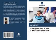 Copertina di Röntgenbilder in der Kinderzahnheilkunde