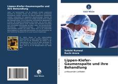 Bookcover of Lippen-Kiefer-Gaumenspalte und ihre Behandlung