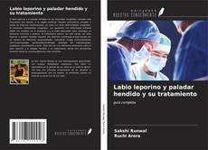 Bookcover of Labio leporino y paladar hendido y su tratamiento