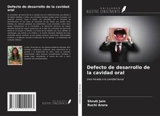 Bookcover of Defecto de desarrollo de la cavidad oral