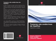 Buchcover von Tumores não endócrinos da hipófise