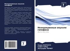 Buchcover von Неэндокринные опухоли гипофиза