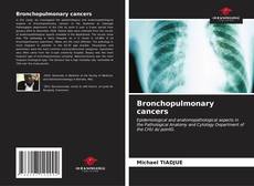 Capa do livro de Bronchopulmonary cancers 