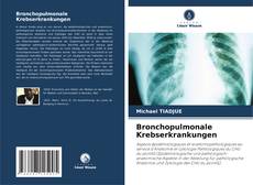 Bronchopulmonale Krebserkrankungen的封面