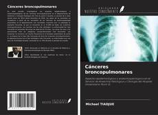 Buchcover von Cánceres broncopulmonares