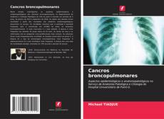 Cancros broncopulmonares kitap kapağı