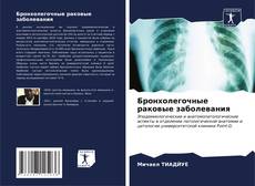 Buchcover von Бронхолегочные раковые заболевания