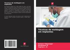 Bookcover of Técnicas de moldagem em implantes