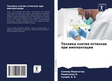 Bookcover of Техника снятия оттисков при имплантации