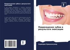 Buchcover von Повреждения зубов в результате люксации