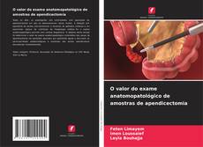 O valor do exame anatomopatológico de amostras de apendicectomia的封面