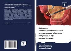Capa do livro de Значение анатомопатологического исследования образцов, полученных при аппендэктомии 
