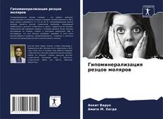 Bookcover of Гипоминерализация резцов моляров