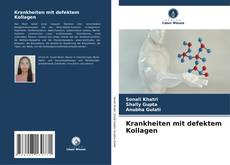 Bookcover of Krankheiten mit defektem Kollagen