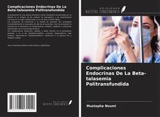 Copertina di Complicaciones Endocrinas De La Beta-talasemia Politransfundida
