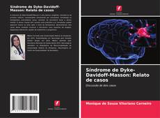 Buchcover von Síndrome de Dyke-Davidoff-Masson: Relato de casos