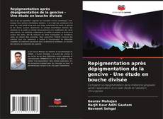 Buchcover von Repigmentation après dépigmentation de la gencive - Une étude en bouche divisée