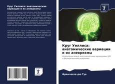 Buchcover von Круг Уиллиса: анатомические вариации и их аневризмы