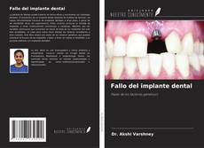 Bookcover of Fallo del implante dental