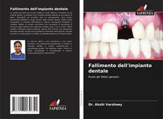 Capa do livro de Fallimento dell'impianto dentale 