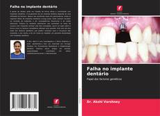 Buchcover von Falha no implante dentário