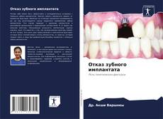 Отказ зубного имплантата kitap kapağı