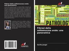 Bookcover of Fibrosi della sottomucosa orale: una panoramica