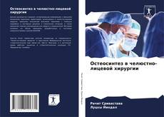 Buchcover von Остеосинтез в челюстно-лицевой хирургии