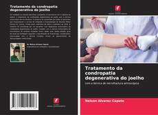 Buchcover von Tratamento da condropatia degenerativa do joelho